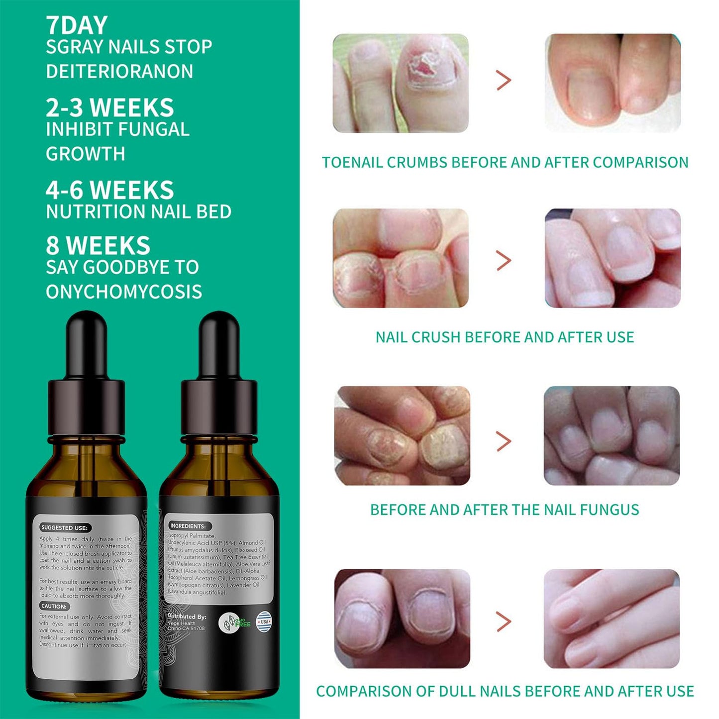 Metanail Toenail Treatment Nail Growth Treatment for Toenail Treatment Extra Strength for Repairing Damaged and Discolored Nails