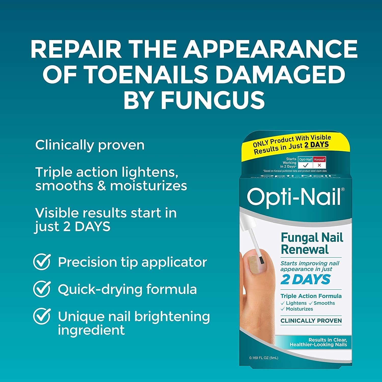 Opti-Nail Fungal Nail Repair with Brush Applicator, Restores the Healthy Appearance of Nails Discolored or Damaged by Nail Fungus