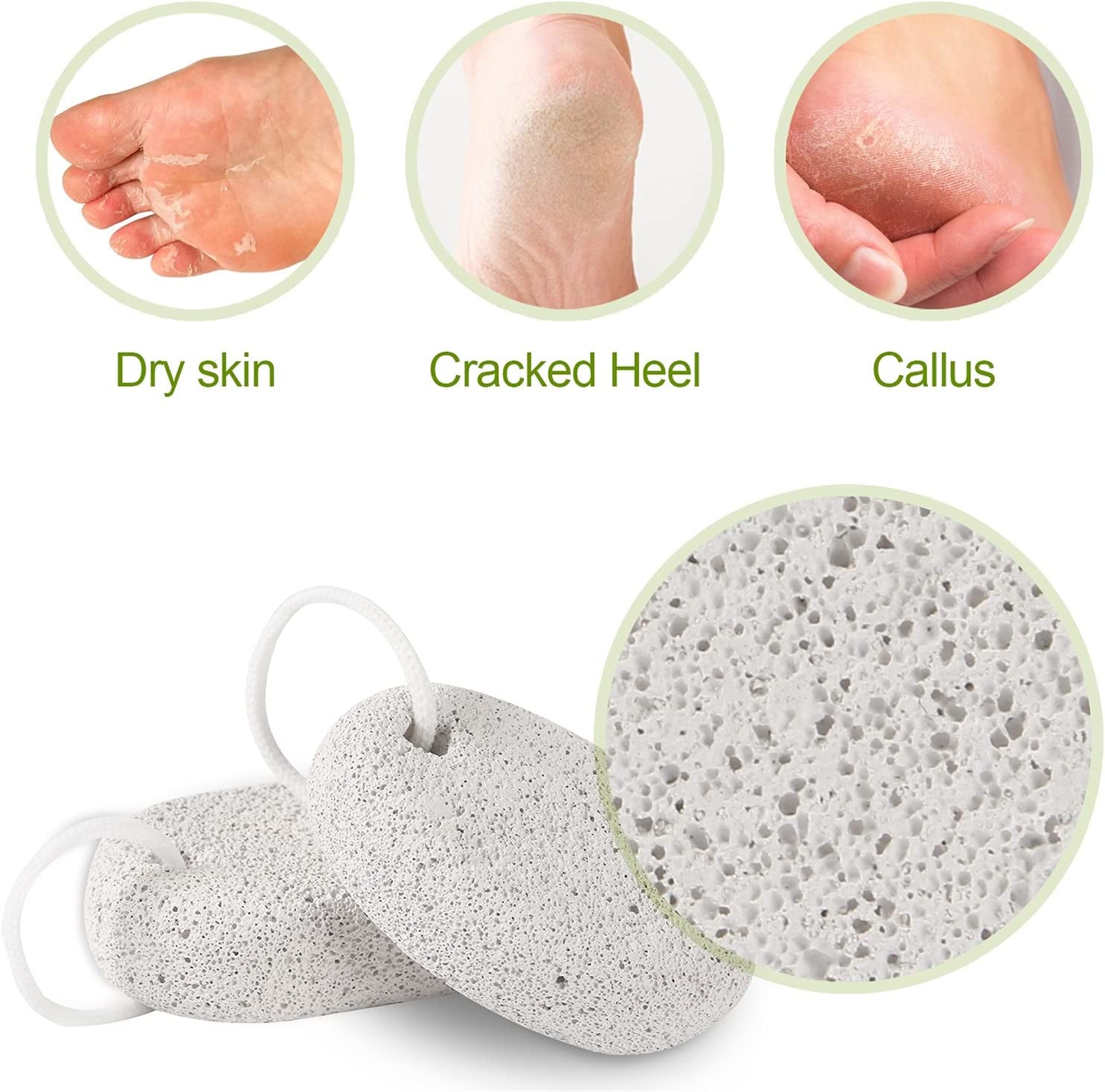 2PCS Natural Pumice Stone,  Lava Pedicure Tools Hard Skin Callus Remover for Feet and Hands - Foot File Exfoliation to Remove Dead Skin, and Callusess