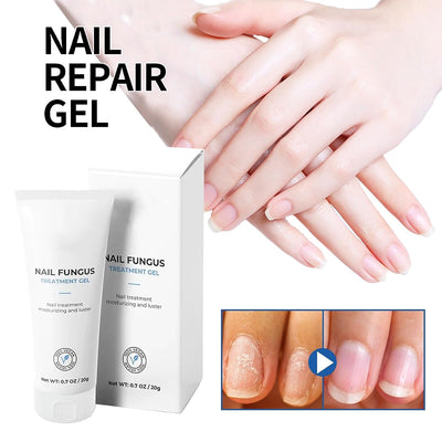 3Pcs Healio Nail Gel,Nail Fungus Remover, Nail Strengthener,Healio Nail Gel for All Nail Types