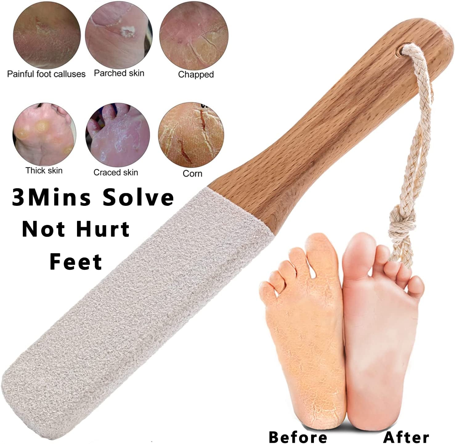 Callus Remover Foot Scrubber Colossal Foot File Foot Care and Foot Exfoliator Foot Rasp Pedicure Tools Pumice Stone for Feet,Remove Corn Hard Skin Dead Skin for Use in Shower Foot Scraper Kit