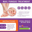 Fungus Treatment for Toenail & Finernails 1 OZ - Shiny Nails