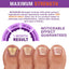 Fungus Treatment for Toenail & Finernails 1 OZ - Shiny Nails