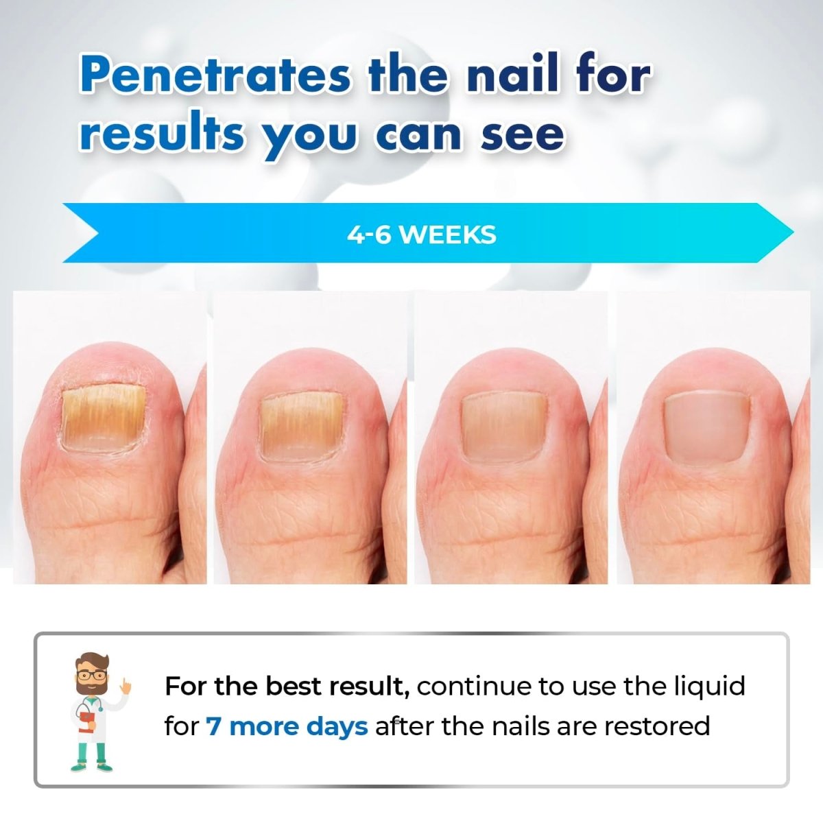 Toenail Fungus Treatment: 30Ml, Nail File & 5 Nail Brushes - Shiny Nails